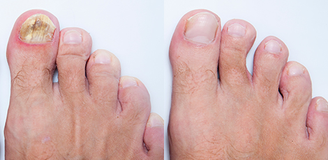 INFORMACJE DERMATOLOGICZNE