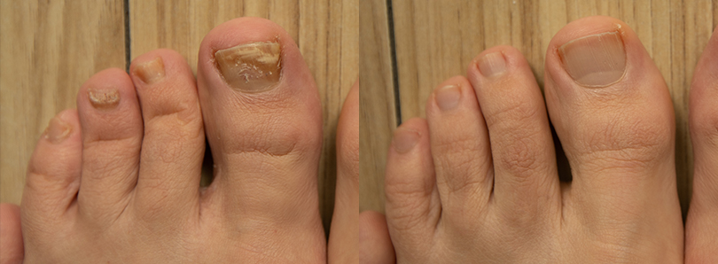 INFORMACJE DERMATOLOGICZNE